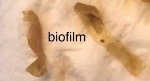 Biofilm