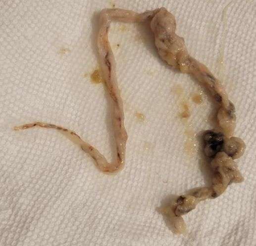 Ropeworm