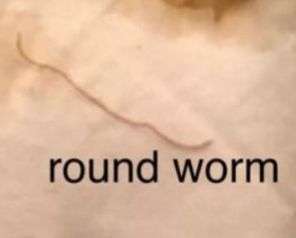 Roundworm